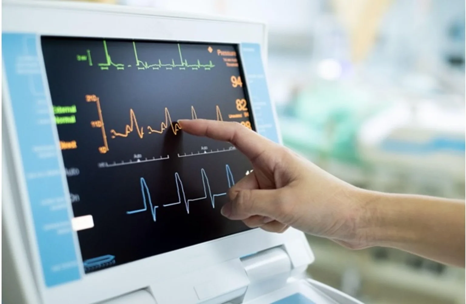 3-Lead vs 5-Lead: Choosing the Right ECG Monitoring System for Your Facility